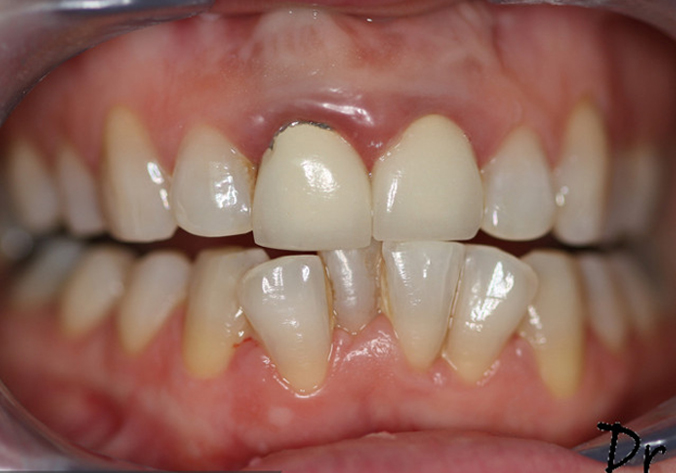 Before -  Dr Payaman