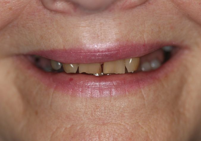 Before -  Dr Payaman